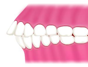 矯正歯科 小田原で歯並び 噛み合わせ治療なら 森井歯科医院